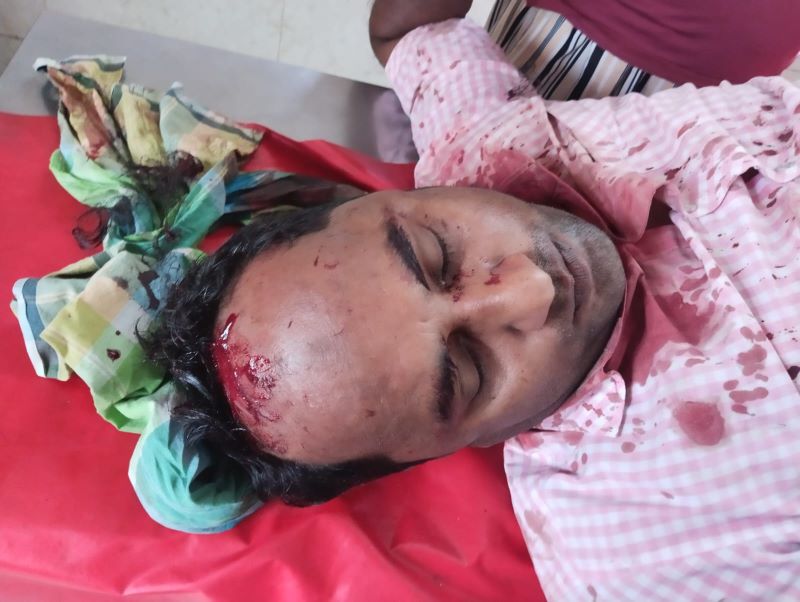 ঈশ্বরদীতে সিএনজি স্ট্যান্ড দখল নিয়ে বিএনপির দুই গ্রুপের সংঘর্ষ, গুলিবিদ্ধ ১